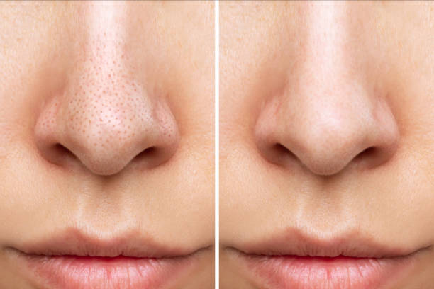 DermaClean Pro™: Limpieza facial profunda tipo spa en casa
