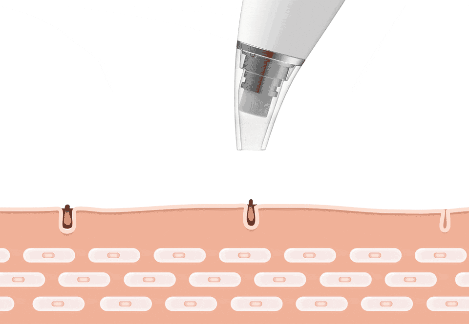 DermaClean Pro™: Limpieza facial profunda tipo spa en casa