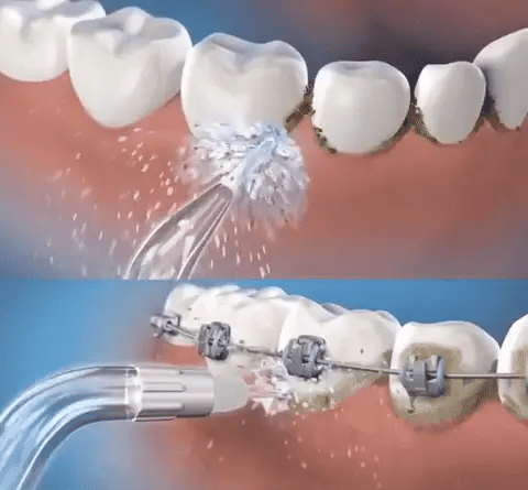 AquaSmile™ Irrigador Oral