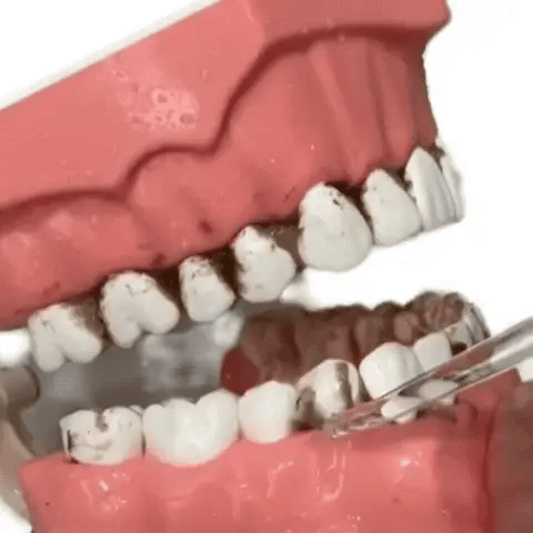 AquaSmile™ Irrigador Oral